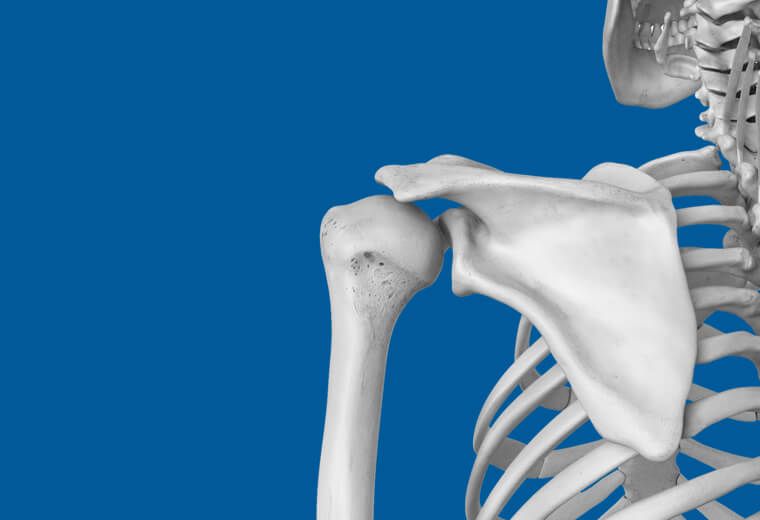 Arthrose de l'épaule