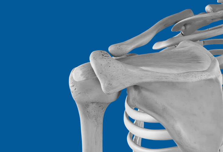 Coiffe des rotateurs