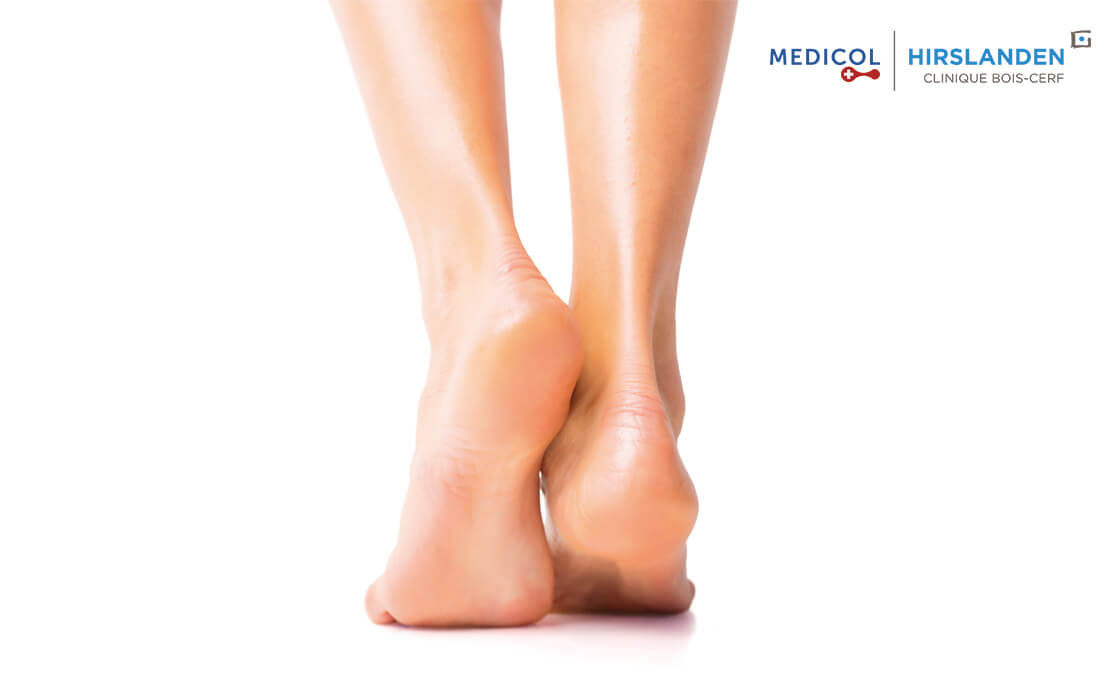 Hallux Limitus Fonctionnel: traitement chirurgical