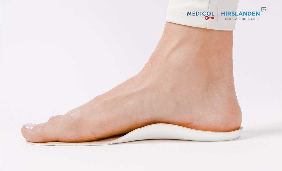 Le pied plat décompensé de l'adulte