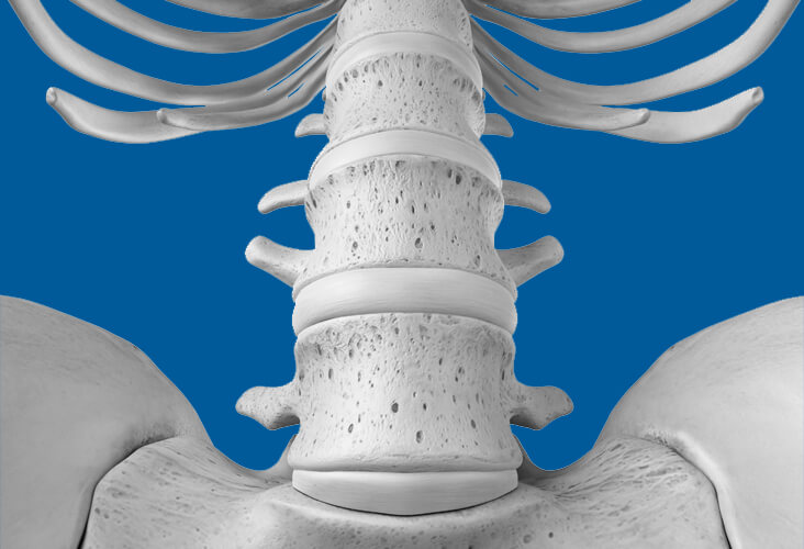 Hernie discale lombaire