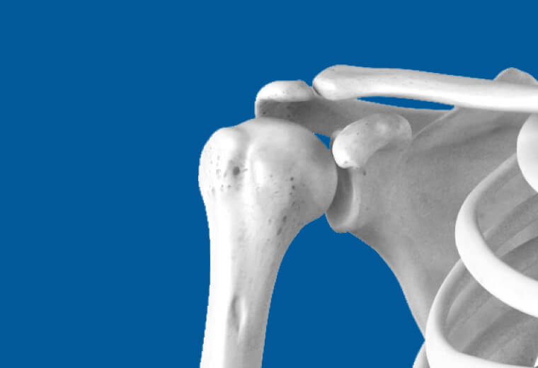 Instabilité de l'épaule