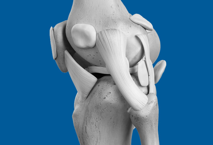 Lésions des ligaments