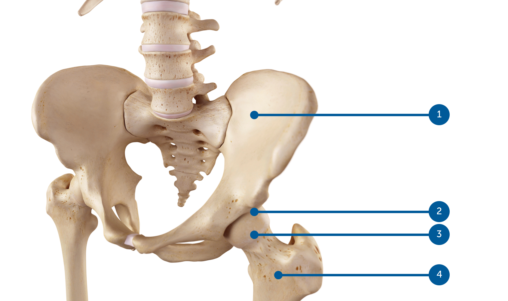 Arthrose de la hanche