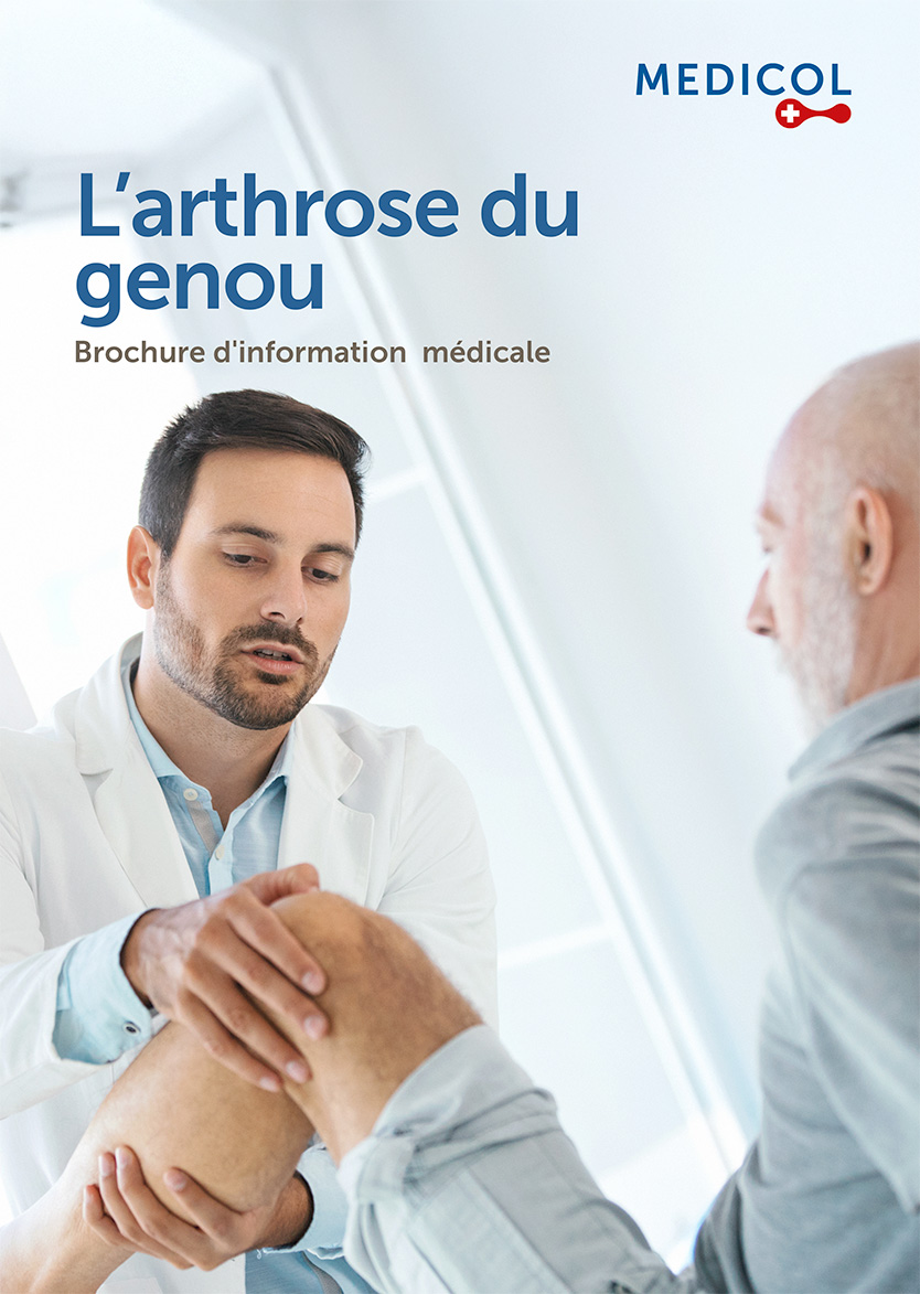 Brochure arthrose du genou