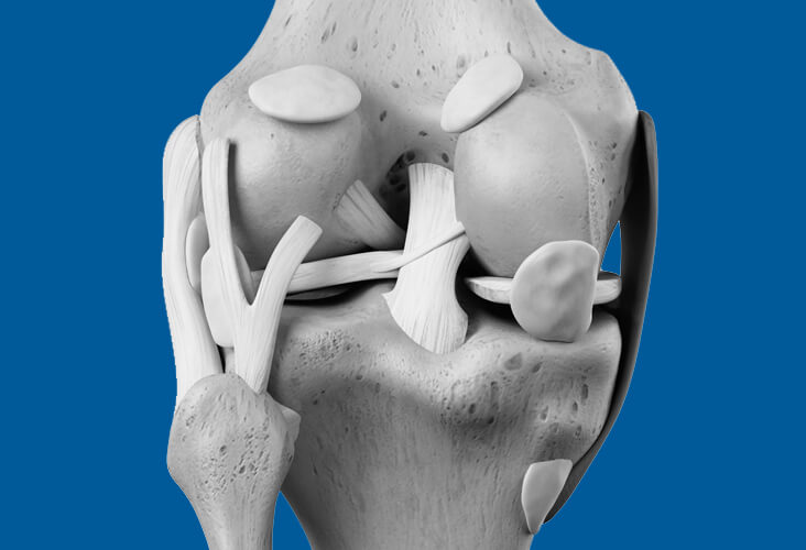 Reconstruction du LCA