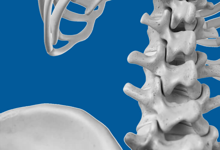 Sténose spinale lombaire