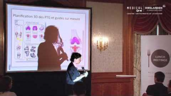 Prothèses de genou: nouvelles avancées