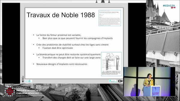 Origines de la PTH sur mesure