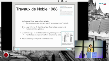 Origines de la PTH sur mesure