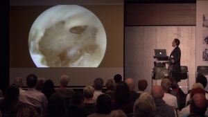 T&eacute;nolyse du Flexor Hallucis Longus