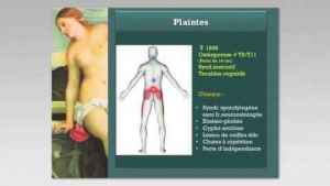 Vieillissement du dos: quel traitement conservateur?