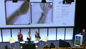 Fractures du radius distal, table ronde et cas choisis