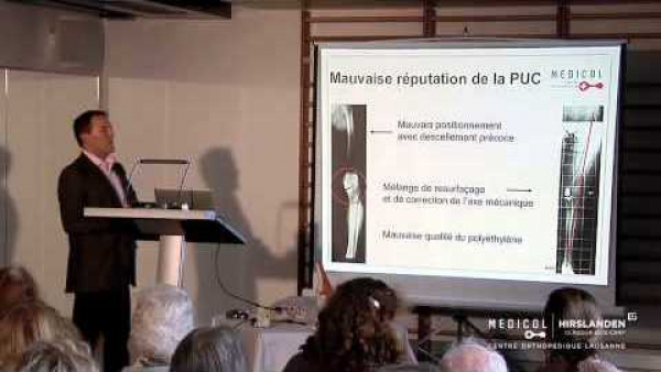 La prothèse du genou dans tous ses états