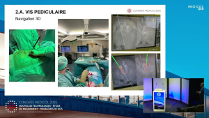 Avanc&eacute;es en chirurgie