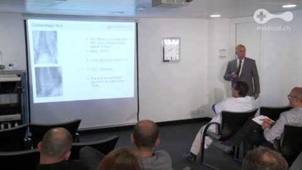 Le traitement anticoagulant en orthopédie