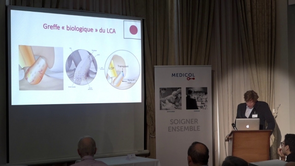 Chirurgie méniscale et ligamentaire: quoi de neuf en 2019?