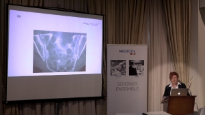 Les spondylarthropathies