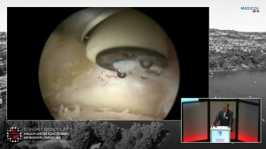 Chirurgies comment&eacute;es