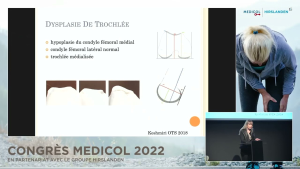 La dysplasie trochléenne