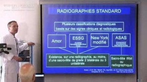 Imagerie des articulations sacro-iliaques dans SPA