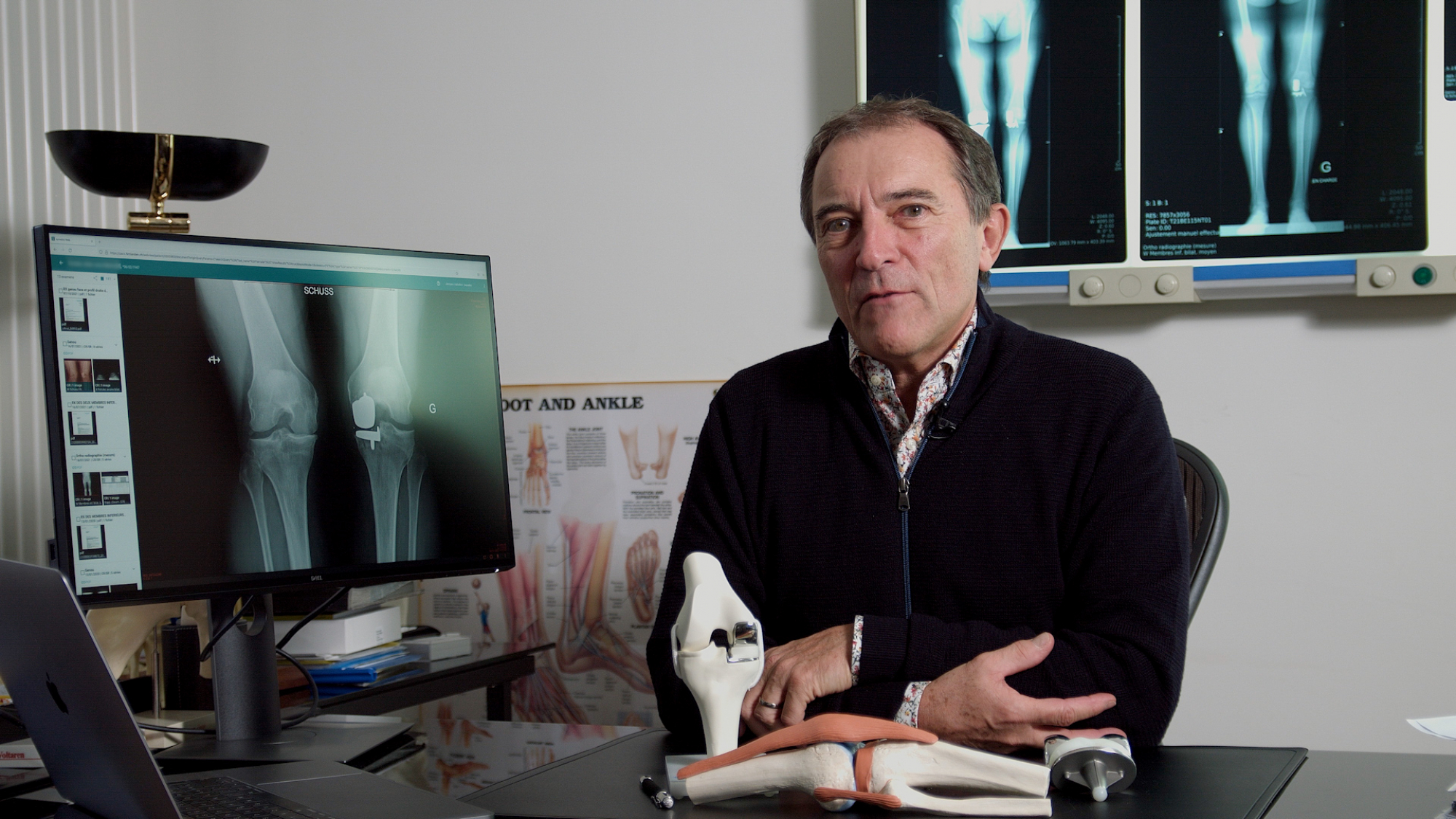 Chirurgie de révision après prothèse du genou: privilégier le résultat fonctionnel