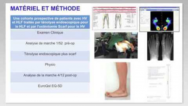 Bilan et analyse de la marche