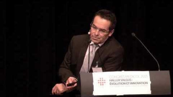 Unilateral vs. simultaneous bilateral primary Hallux Valgus correction surgery. Prospective Analysis