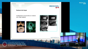 Facteurs de risque et diagnostic différenciel