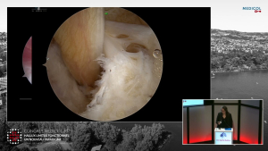 Trucs et astuces, et gestes associ&eacute;s