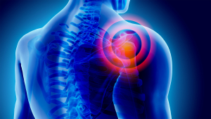 De la r&eacute;paration de la coiffe des rotateurs &agrave; la proth&egrave;se d&rsquo;&eacute;paule