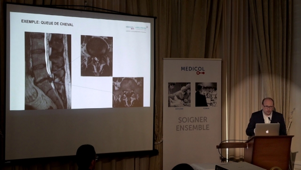 Sciatalgies: traitements et chirurgie