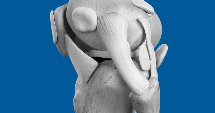 Lésions des ligaments