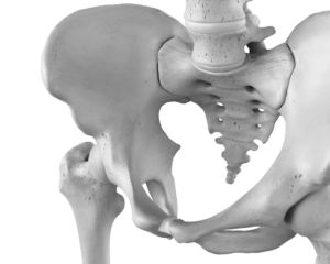 Pathologie de la hanche