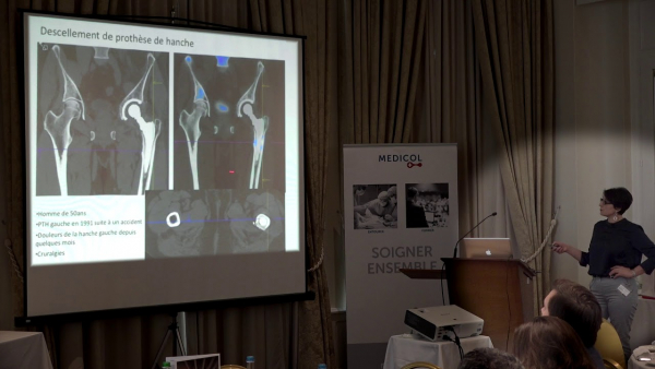 Médecine nucléaire - SPECT-CT: état actuel et applications cliniques