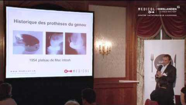 Prothèses de genou: nouvelles avancées