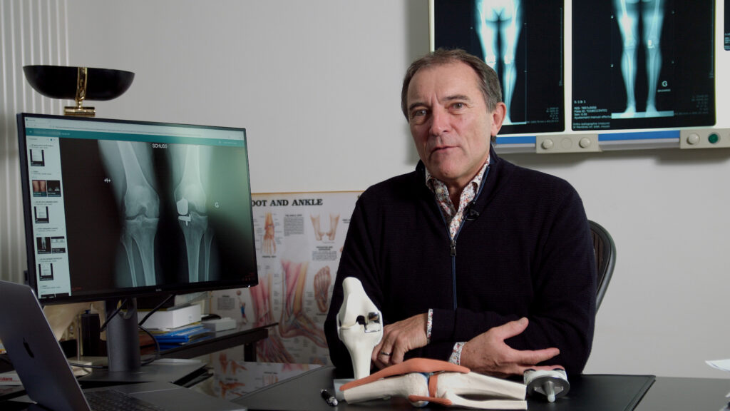 Chirurgie de révision après prothèse du genou: privilégier le résultat fonctionnel