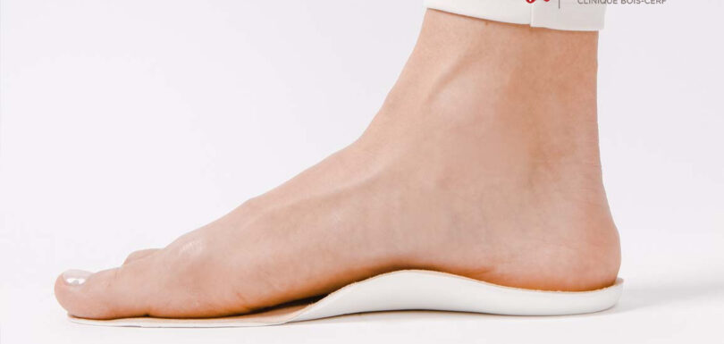 Le pied plat décompensé de l'adulte
