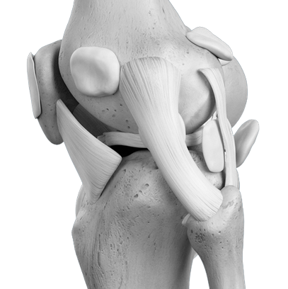 Lésions des ligaments