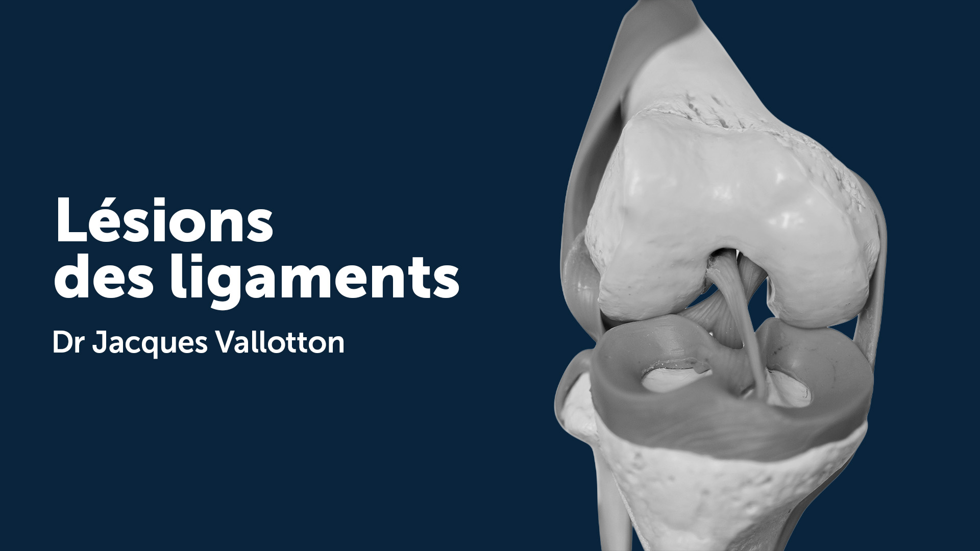 Lésion des ligaments