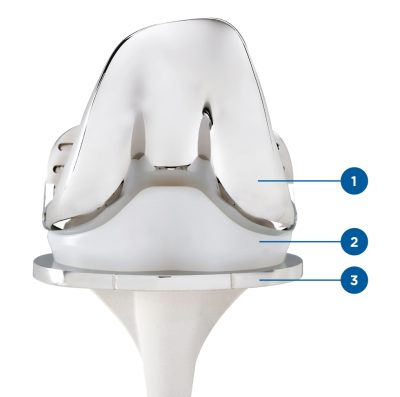 arthrose_du_genou_05